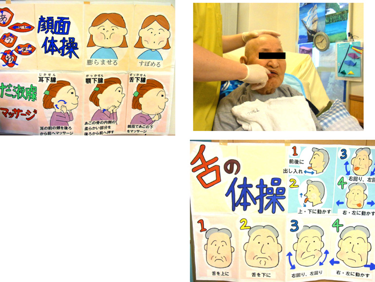 口腔リハビリテーションを取り入れるだけでも食べる機能が改善することも